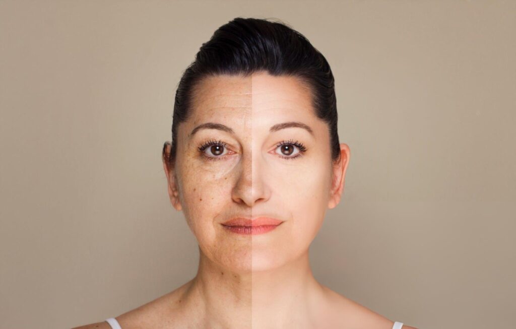 Reduce Wrinkles Naturally